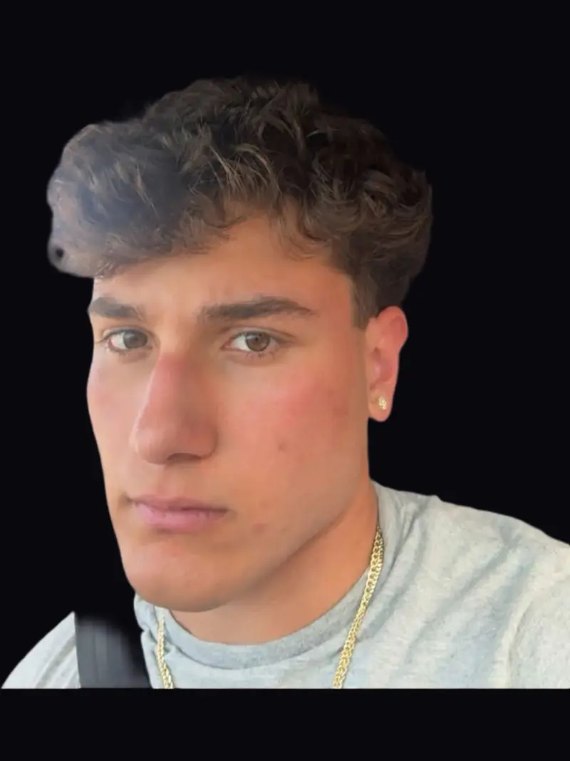 Community member after photo, facial structure